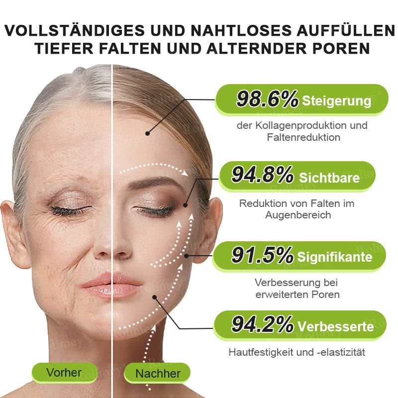 👨‍⚕️Jetzt jugendliche Haut zurückgewinnen 💫Rolimey® Botox & Vita-A Retinol Shot Falten-Lift Straffungscreme