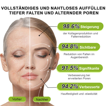 👨‍⚕️Jetzt jugendliche Haut zurückgewinnen 💫Rolimey® Botox & Vita-A Retinol Shot Falten-Lift Straffungscreme
