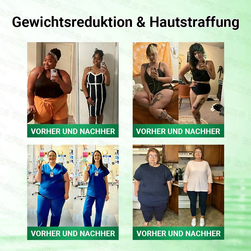 Offizieller Store 🇩🇪 |🦅𝐆𝐅𝐎𝐔𝐊® Moringa · Berberin × NAD+ 10-in-1 Advanced Nano Mikronadel-Patch 🇩🇪 (Nur einmal täglich, sichtbare Veränderungen in 7 Tagen) ✅ Für Fettleibigkeit, schlaffe Haut, Diabetes, Schlafapnoe, Gelenkprobleme und mehr