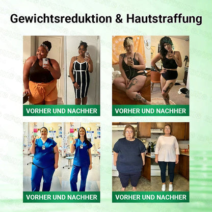 Offizieller Store 🇩🇪 |🦅𝐆𝐅𝐎𝐔𝐊® Moringa · Berberin × NAD+ 10-in-1 Advanced Nano Mikronadel-Patch 🇩🇪 (Nur einmal täglich, sichtbare Veränderungen in 7 Tagen) ✅ Für Fettleibigkeit, schlaffe Haut, Diabetes, Schlafapnoe, Gelenkprobleme und mehr