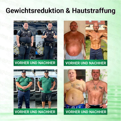 Offizieller Store 🇩🇪 |🦅𝐆𝐅𝐎𝐔𝐊® Moringa · Berberin × NAD+ 10-in-1 Advanced Nano Mikronadel-Patch 🇩🇪 (Nur einmal täglich, sichtbare Veränderungen in 7 Tagen) ✅ Für Fettleibigkeit, schlaffe Haut, Diabetes, Schlafapnoe, Gelenkprobleme und mehr